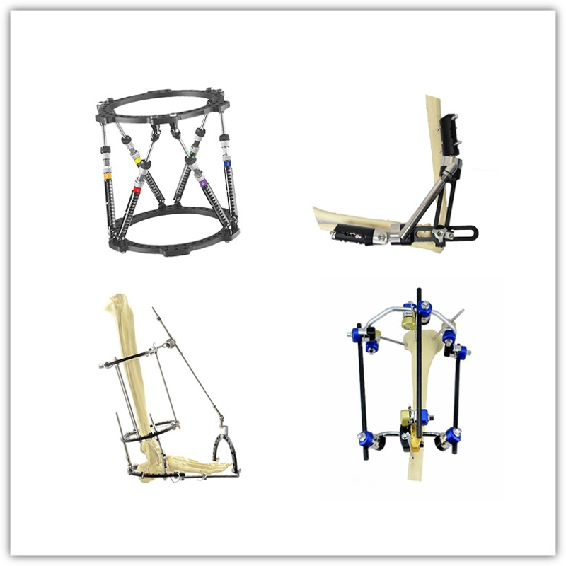 https://shopcdnalpha.grainajz.com/category/83036/2966/324b50d30d9f3e0f82f7c770b21d93bc/External%20Fixator%20System.jpg