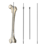 The application advantages of femoral intramedullary nails in pediatric fractures