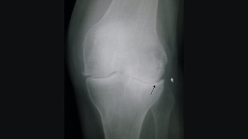 X-ray interpretation (ABCS approach)