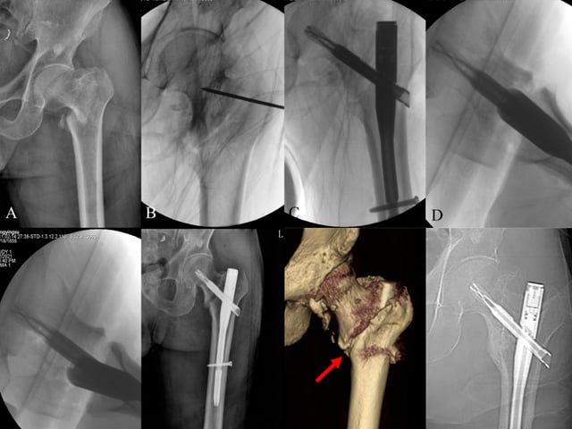 Characteristics and Surgical Techniques of the 