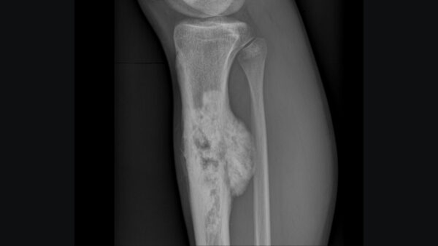 X-ray interpretation (ABCS approach)