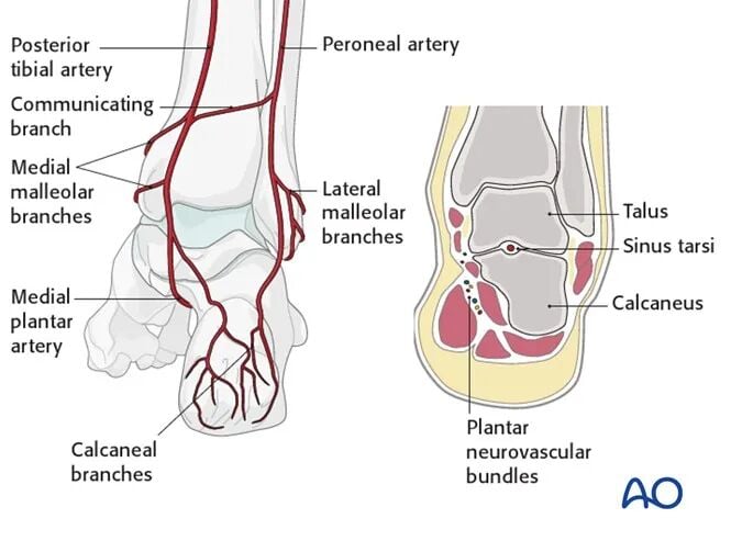 AO Standard Surgery: Screw Fixation for Displaced Talar Neck Fractures