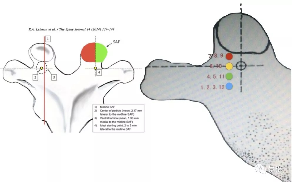 Pedicle Screw Placement Techniques for the Cervical, Thoracic, and Lumbar Spine