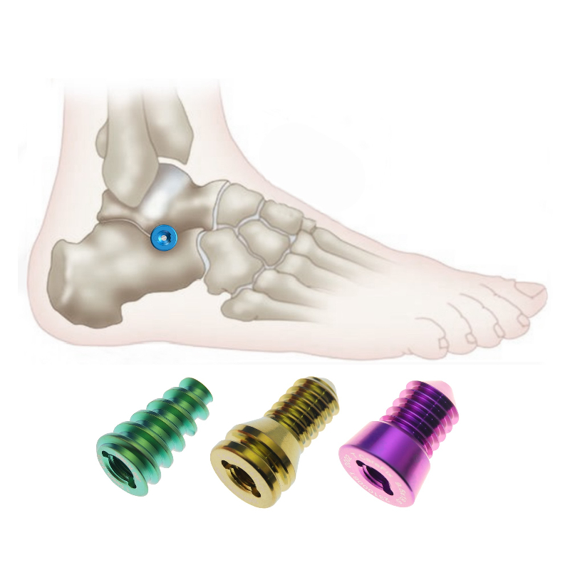 Superior Biomechanical Performance