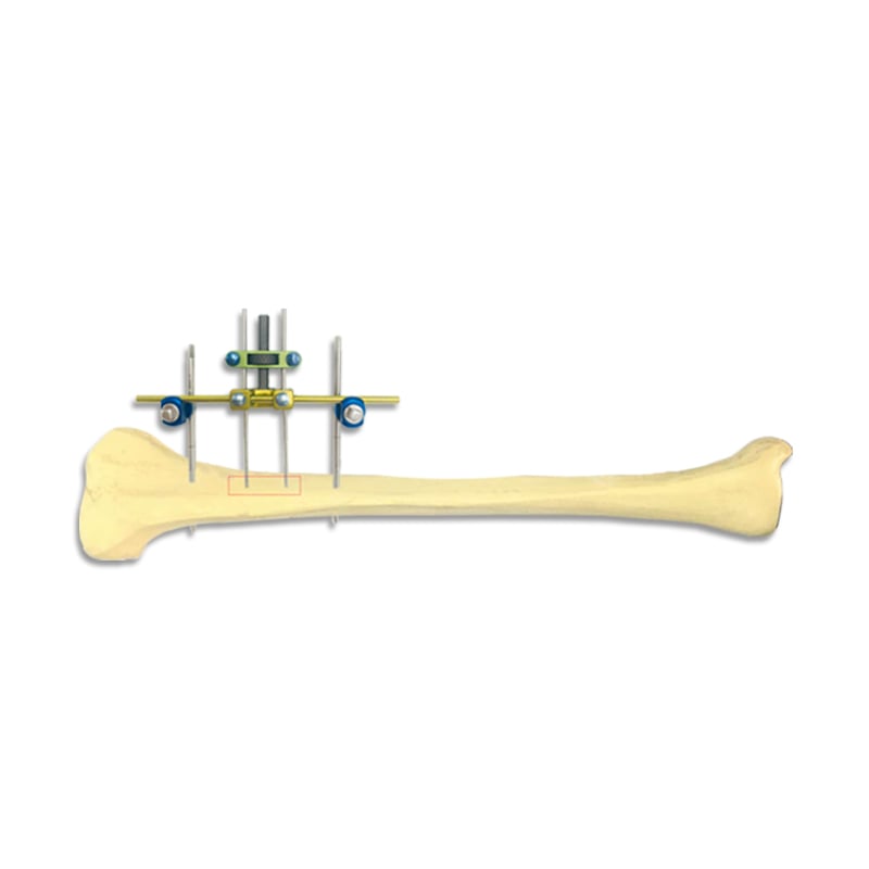 Bone Retraction 3mm Combined System