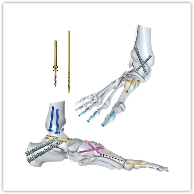 https://shopcdnalpha.grainajz.com/category/83036/2966/967975016dce24818e62045b24477d0d/Pins%26Screws.jpg