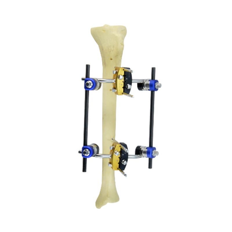 Bilateral Standard Configuration of Combined External Fixator