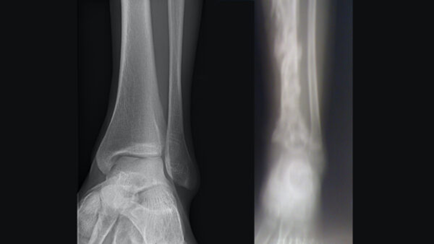 X-ray interpretation (ABCS approach)