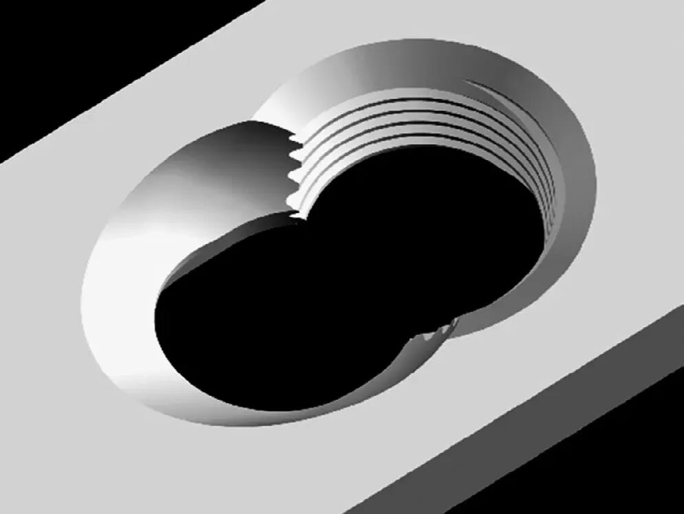 Locking Compression Plate (LCP): Principles and Clinical Applications