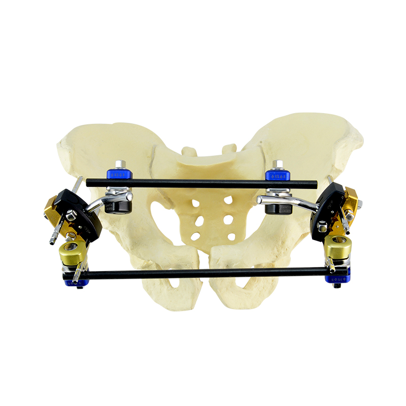 Plevic Standard Configuration of Combined External Fixator
