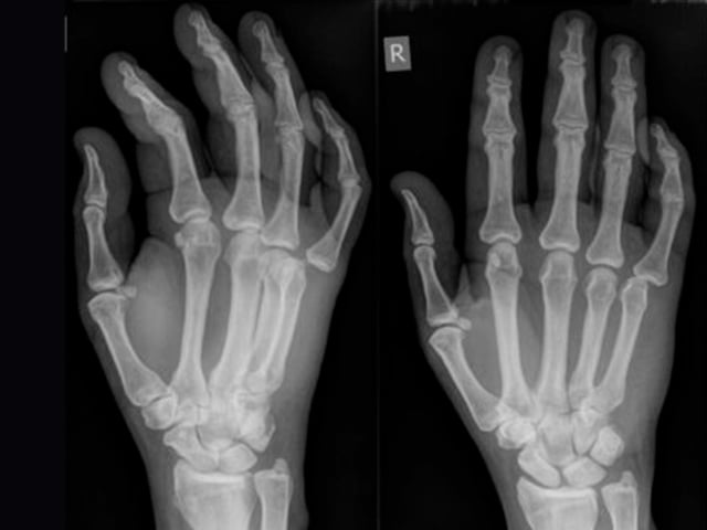 X-ray interpretation (ABCS approach)
