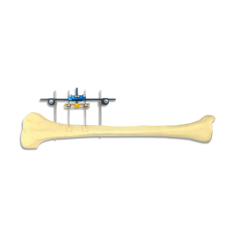 Bone Retraction 5mm Combined System