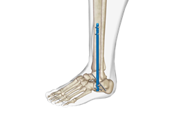 image(96d01a7409).png