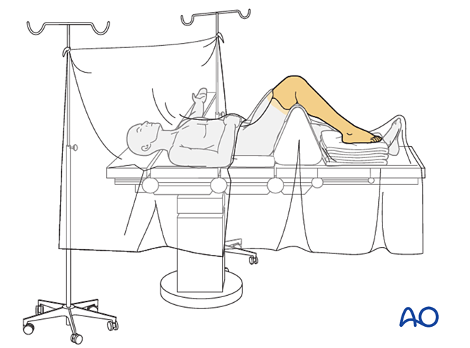 IV. Approach Preparation