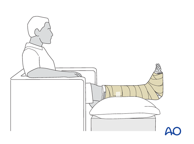 IV. Approach Preparation