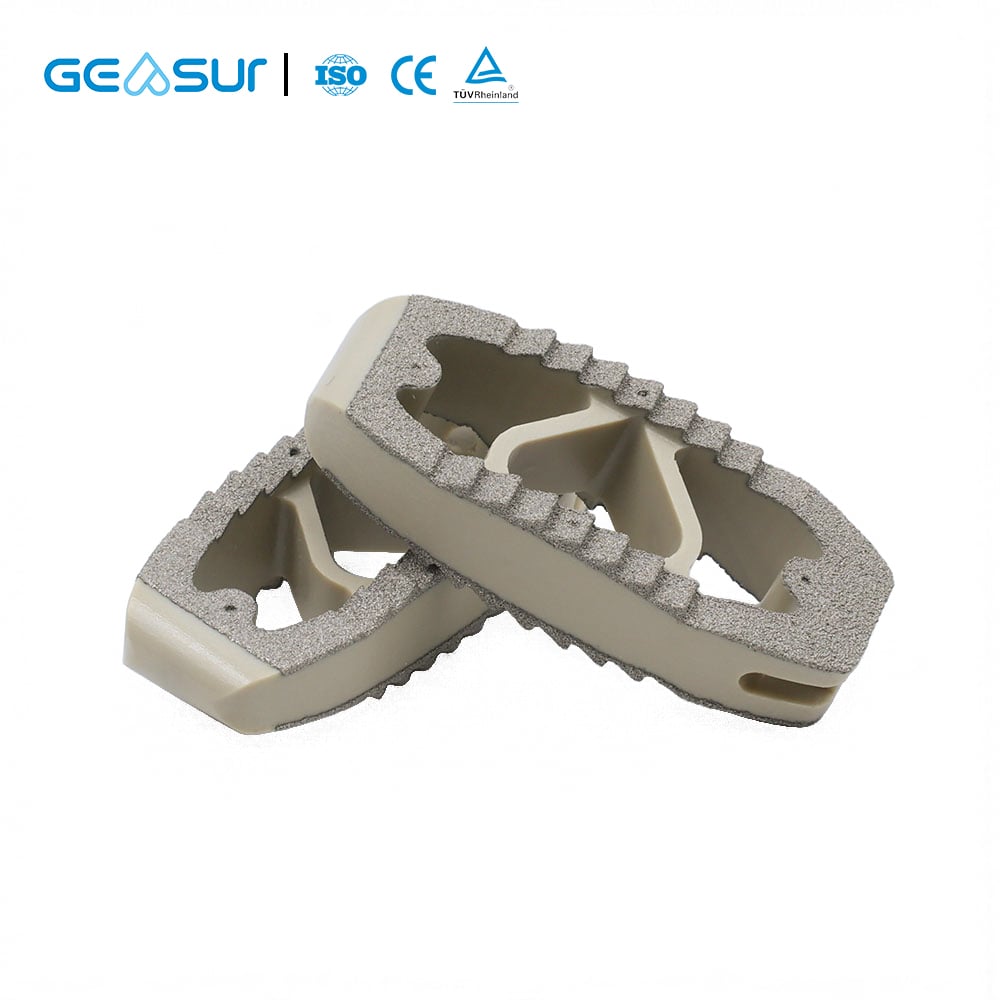 Titanium Coated PEEK Cage for Spinal Fusion Surgery Improving Spinal Stability for Patients