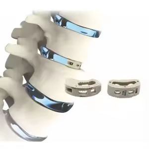 PEEK Cage Factories for OEM Orders Customizing Products for Orthopedic Partners