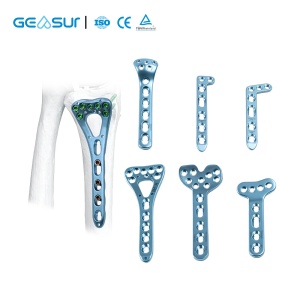 Radius Locking Plates for Radius Fractures Accelerating Patient Recovery
