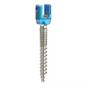 Pedicle Screws for Spine Use Key to Successful Spinal Surgery